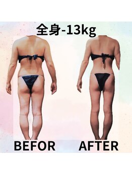 サロンド ヴィーナス 葛西店/全身痩せハイパーナイフEX