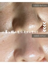 ザ プレザント 大倉山(the pleasant)/クリスティーナのビオフィート