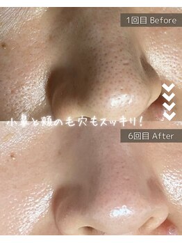 ザ プレザント 大倉山(the pleasant)/クリスティーナのビオフィート