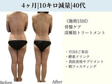 京都フォーエイチ(京都4H)/40代|4ヶ月|－10キロ|施術15回