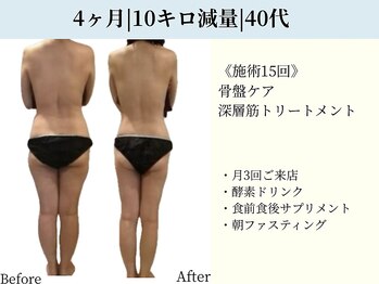 京都フォーエイチ(京都4H)/40代|4ヶ月|-10キロ|施術15回