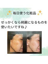 柚子/ホームケアだけで綺麗になる♪