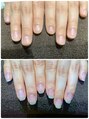 エヌドットバーバーヒロオ ネイル(N.BARBER HIROO) 縦長の爪に導く【育爪】日々のお手入れもおまかせ下さい♪