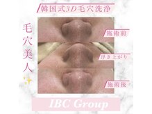 トータルサロンアイビーシー(トータルサロンIBC)/大人気！ 毛穴洗浄