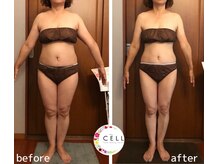 セル(CELL)の雰囲気（【産後ケア/ぽっこりお腹】運動は苦手だけど痩せたい方◎腸もみ）