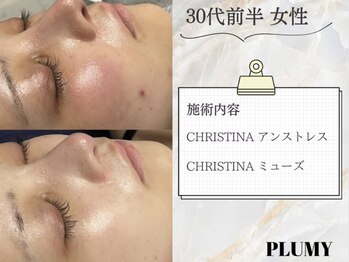 プリューミー(PLUMY)/CHRISTINA Before/After