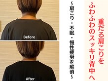 テルケル 佐賀