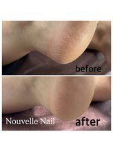ヌーベルネイル(Nouvelle Nail)/足裏角質ケア