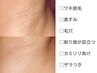 全身スタート前に【美肌脱毛/セレクト1箇所】お試し￥5500