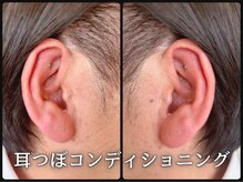 ルース(LUZ)/メンズ耳つぼコンディショニング