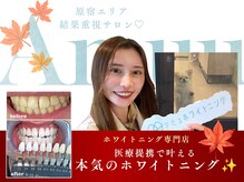 アミュホワイトニング