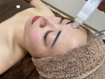 モエザ(MoeZ)の写真/【毛穴の黒ずみでお悩みの方必見!!】ハイドラフェイシャルで古い角質や皮脂を取り除き、毛穴の汚れを除去☆