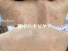 【選べるBODY】ハーブピーリング/ハーブリプロ¥22,000