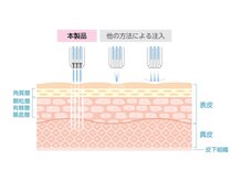 ワイアンドワイ(Y&Y)/水光Airで無針の時代/平塚エステ