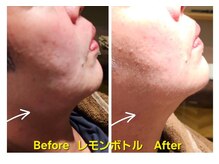 アン 銀座(ann)/レモンボトル