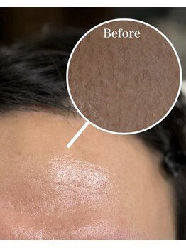 プラスアイビー 博多駅前店(+i.b)/自信あるおでこ目指しましょう。