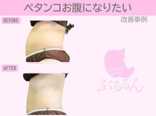 ぷるるんエステ/痩身/ダイエット/整体