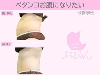 ぷるるんエステ/痩身/ダイエット/整体