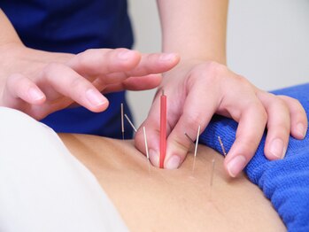 ほねごり接骨院 はりきゅう院 東久留米下里院/【自律神経の乱れに】鍼灸施術