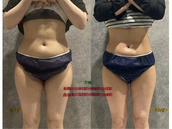 リボーン(REBORN)/美容ダイエット