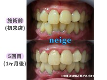 ネージュ(neige)/60代前半/女性