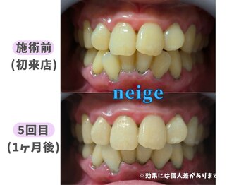ネージュ(neige)/60代前半/女性