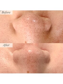 ビエン(Bien)/フェイシャルワックス