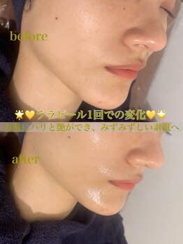 エムラボ 池袋店(M LABO)/ララピール