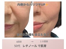 リアン(Lien)の雰囲気（ほうれい線・たるみ毛穴に◎結果重視のレチノールケアで肌育）