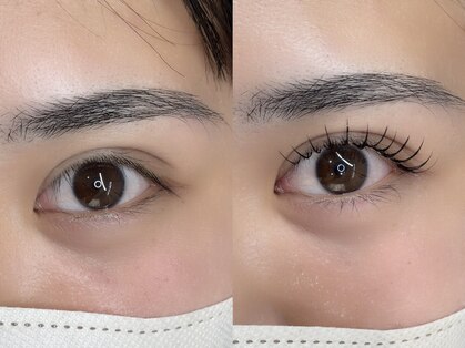 グレース(Grace)の写真