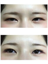 アンジェリーク 八王子店/一重の悩み。。。