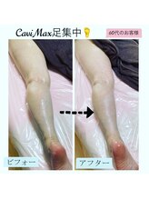 ランプ(Lampe)/◇鬱血気味のお疲れ足◇