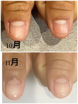 グレースレディ 神戸北店/