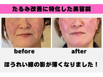 ねこのひげ/お客様の変化