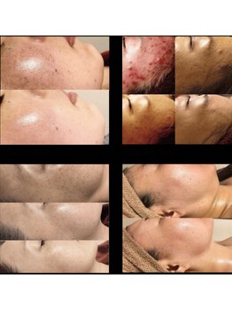 マロン(marron)/リアボーテハーブトリートメント