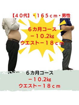穴田鍼灸整骨院/【40代】ダイエット事例