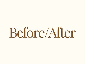 ジョンミー(JONMEE)/Before&After紹介