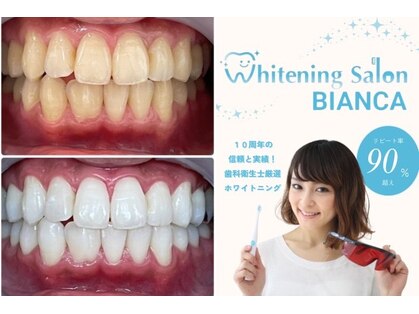 ホワイトニングサロン ビアンカ 浜松若林店(BIANCA)の写真