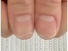 【二枚爪の方に】薄く割れやすい爪を健康な爪へ◎美爪育成ケア