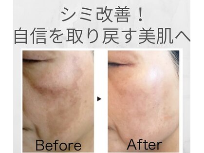 デアルーチェ(DEA LUCE)の写真