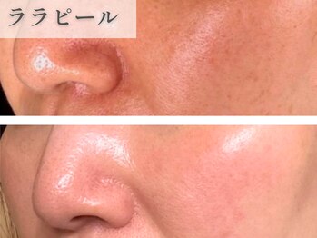 南青山コスメクリニック スキンラボ 横浜(SKIN LAB)/ララピール
