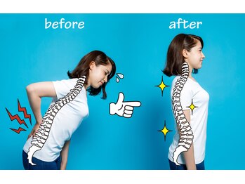 ティル(TILL)/美姿勢作りのサポートいたします