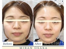 ミランオオサカ(MIRAN OSAKA)/パワーリフトアップ！