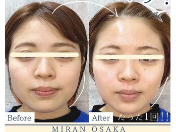 ミランオオサカ(MIRAN OSAKA)/パワーリフトアップ！