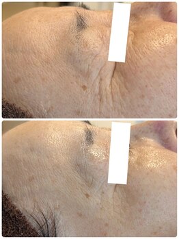 グラサヴォーグ 金沢店/目元印象に変化が(^^)