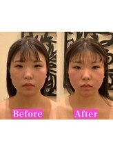 アジール 新潟市(agir)/Before/After画像