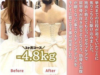 マラウェイ(Mullaway)/ブライダル実績(痩身/美容整体)