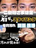 【ご新規様】眉＋お顔の毛穴汚れ徹底洗浄ハイドラフェイシャル
