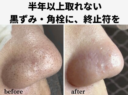 エアル(earu.)の写真