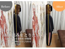 骨盤メディカル整体院 佐賀駅前院の雰囲気（施術前は撮影&現状を確認☆知らぬ間に歪んだ骨盤・足長差を改善!）